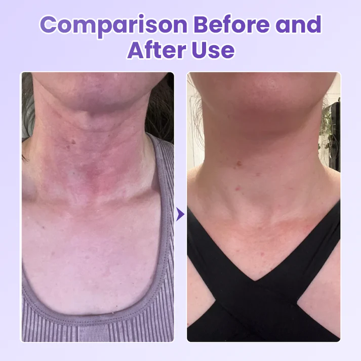 Anti-Wrinkle Neck Patch with Peptides