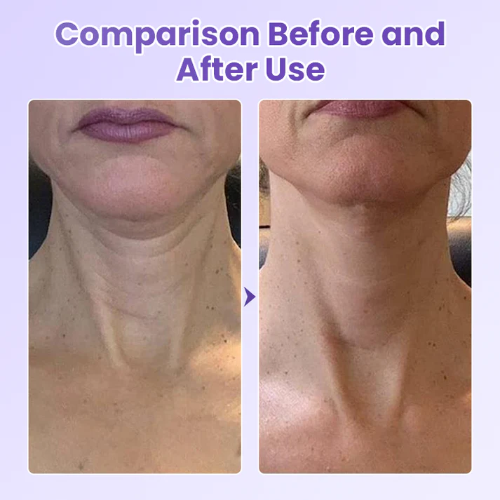 Anti-Wrinkle Neck Patch with Peptides