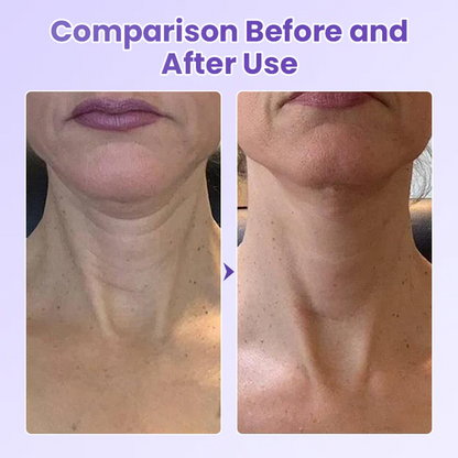 Anti-Wrinkle Neck Patch with Peptides