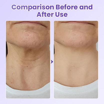 Anti-Wrinkle Neck Patch with Peptides
